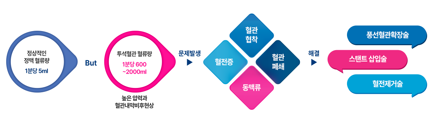 투석혈관 시술 이미지